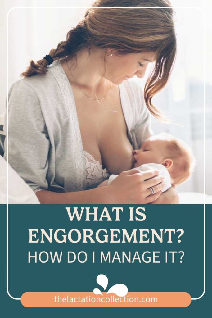 A mother tenderly holding her nursing baby close, with a look of contentment on her face, set against a backdrop with text about managing engorgement.