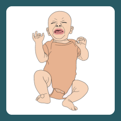 A baby crying loudly, showing a late-stage hunger cue that can indicate they are very hungry.