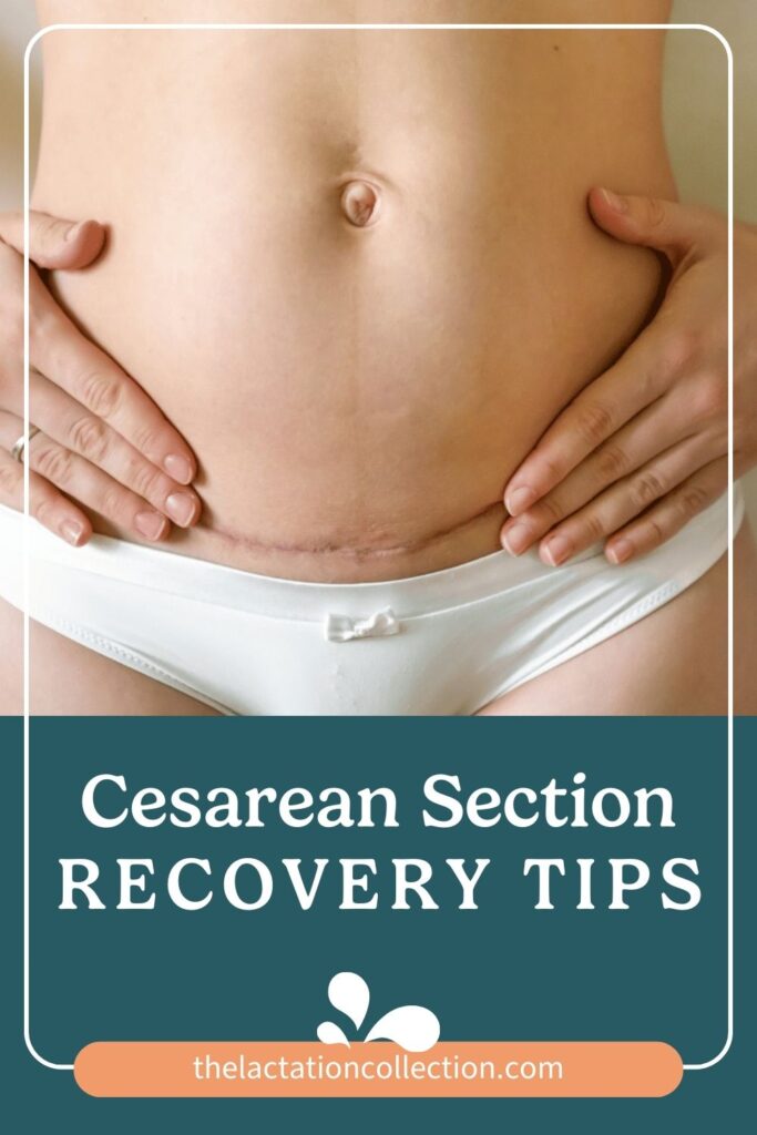 A woman's hands gently framing her cesarean section scar, located on her lower abdomen, just above the underwear line. Above is text 'Cesarean Section RECOVERY TIPS'