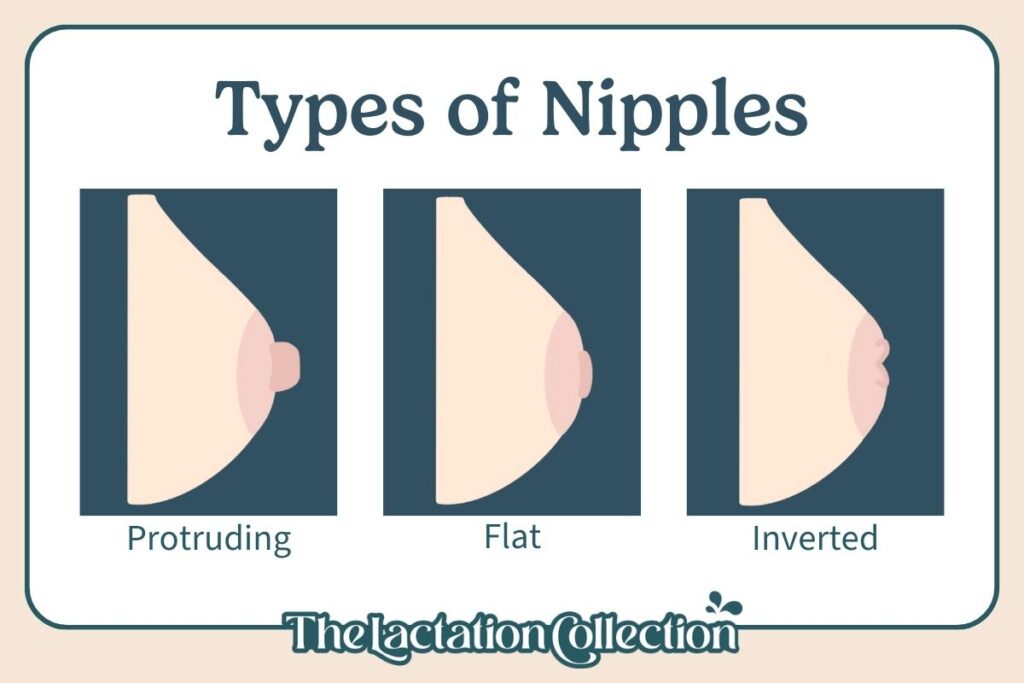 An educational infographic showcasing three different nipple types: protruding, flat, and inverted, to guide new mothers in understanding their own.