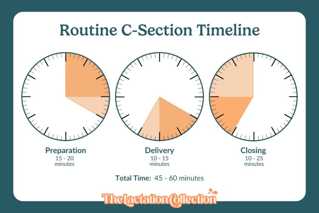 graphic showing a routine c-section timeline: 15-20 minutes of prep, 10-15 minutes for delivery, 10-25 closing