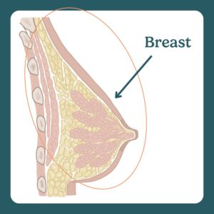 breast