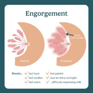 engorgement