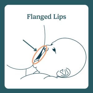 flanged lips