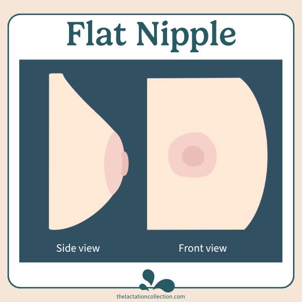 Flat nipple front and side view