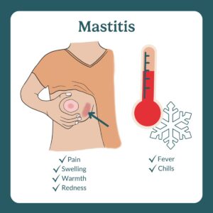 mastitis