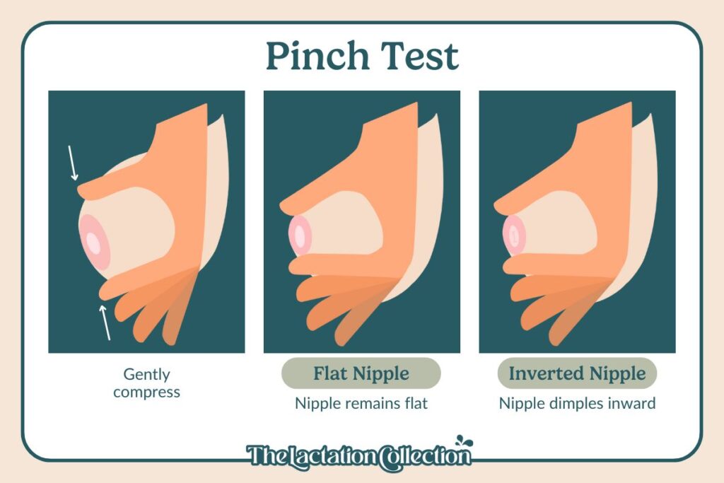 The pinch test to determine if you have flat or inverted nipples for breastfeeding.