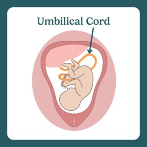 umbilical cord