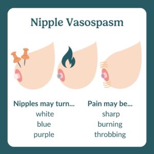 nipple vasospasm