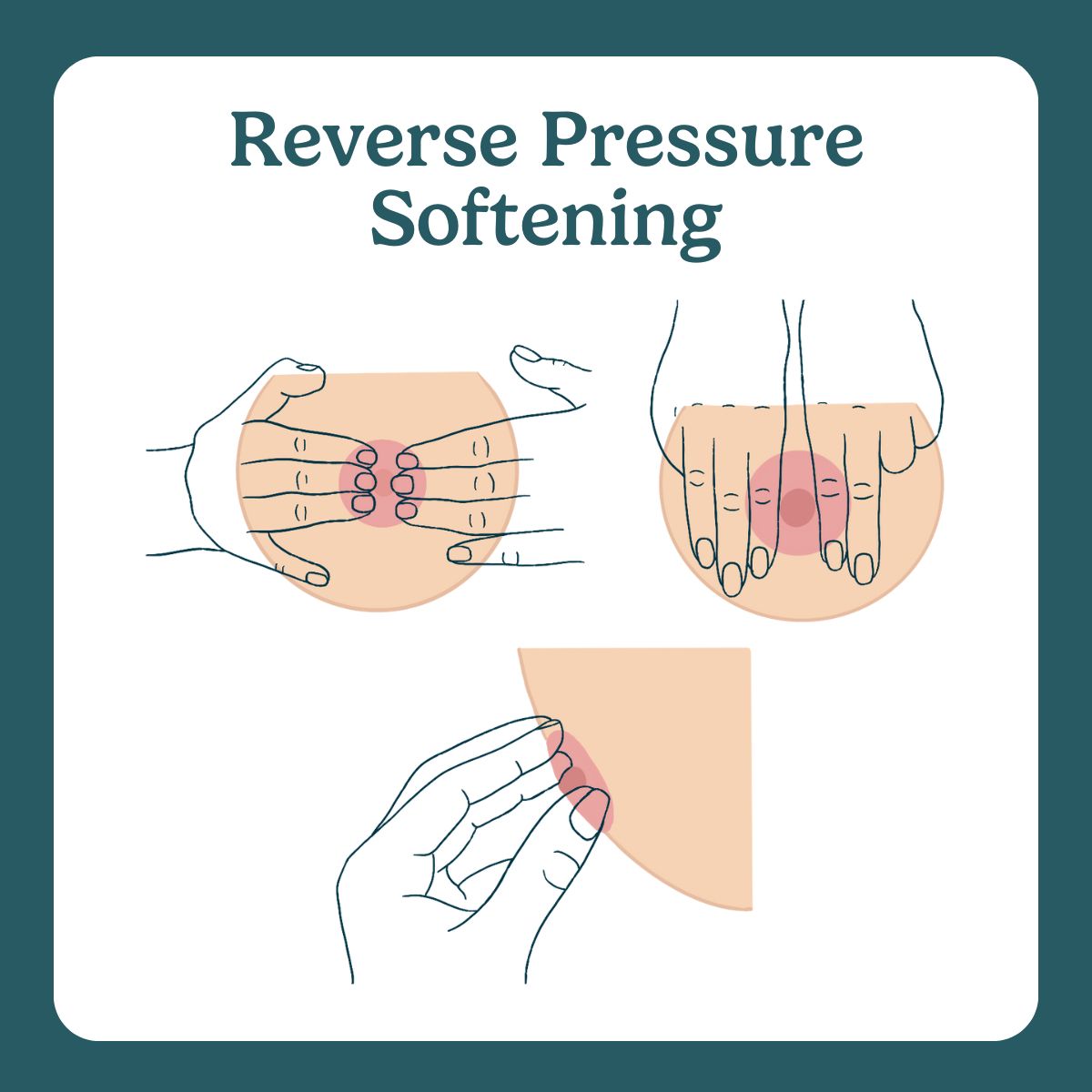 Reverse Recovery Rsoftness reverse pressure softening - Breastfeeding Glossary by The Lactation ...