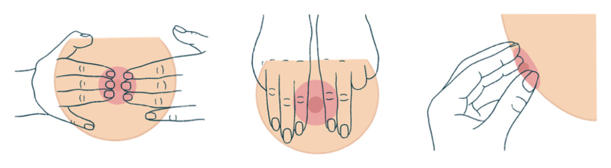 breast reverse pressure softening (RPS) steps