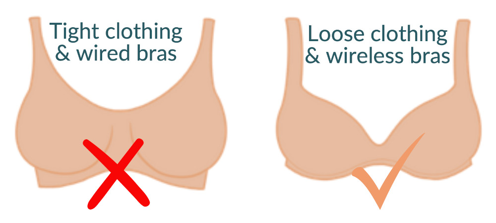 avoid tight clothing and wired bras with engorgement; choose loose clothing and wireless bras